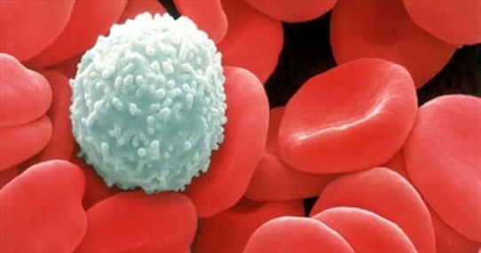 Bác sĩ Viện Huyết học và Truyền máu TW chỉ ra 6 dấu hiệu sớm của bệnh ung thư máu