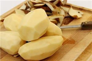 Những lưu ý khi ăn khoai tây để không gây hại cho sức khỏe