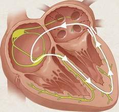 Sốc tim trong nhồi máu cơ tim - Dấu hiệu và cách xử lý hiệu quả