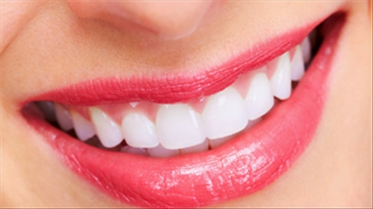 Khắc phục chứng viêm lợi sau khi bọc răng sứ hiệu quả