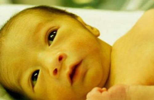 Cách trị bệnh vàng da ở trẻ sơ sinh: Cho con bú đầy đủ giúp giảm tình trạng bệnh