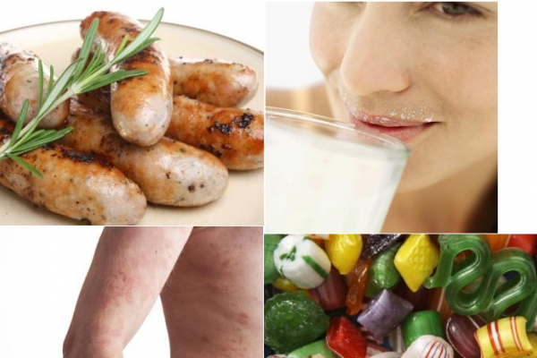 Cảnh báo 4 thực phẩm nên kiêng khi bạn bị viêm da dị ứng