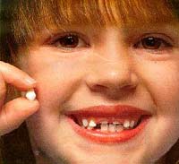 Nguyên nhân trẻ bị sâu răng có phải thực sự do bánh kẹo?