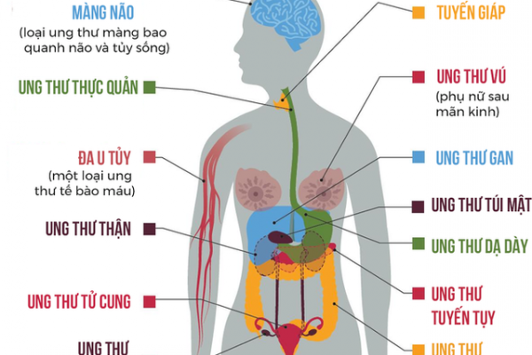 Mối liên quan mật thiết giữa béo phì và ung thư mà bạn chưa biết đến