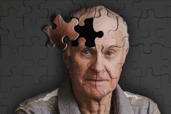 Lưu ý khi chăm sóc người mắc bệnh Alzheimer nhất định phải biết