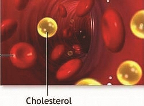 Chế độ ăn uống của người bệnh mạch vành và cao mỡ máu