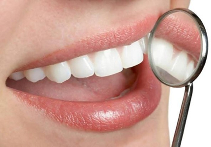 Cần lưu ý trước 6 thực phẩm phá hủy men răng của bạn