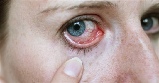 Nhận biết các bệnh dễ mắc qua những triệu chứng bất thường ở đôi mắt