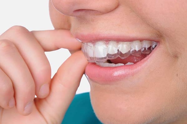 Mách bạn điều trị chứng nghiến răng ở trẻ vô cùng hiệu quả