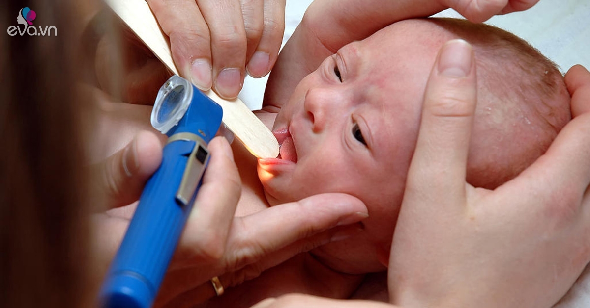 Trẻ sơ sinh bị viêm họng: Những dấu hiệu và cách chữa mẹ cần biết