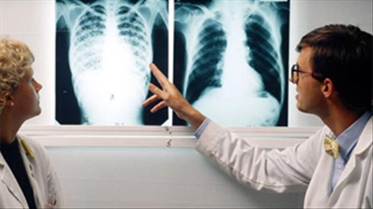 Bệnh lao phổi - 4 nguyên tắc điều trị cần phải biết!