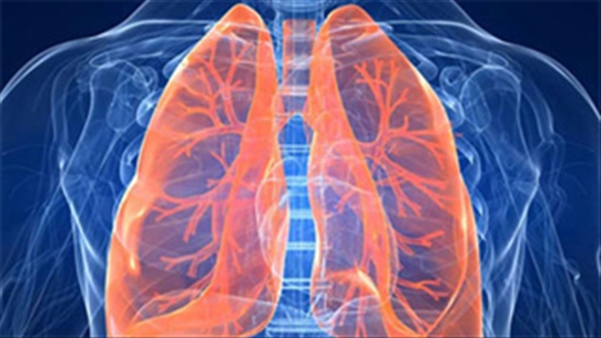 Phẫu thuật ung thư phổi: Cắt hình nêm - những thông tin cơ bản nhất