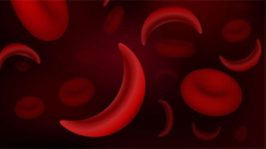 Bệnh thiếu máu hồng cầu hình liềm nguy hiểm như thế nào?