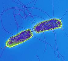 Tiêu chảy cấp do nhiễm khuẩn, những thông tin cần biết bạn nên biết