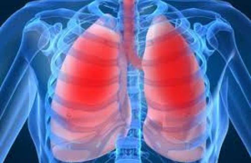 Vi khuẩn phế cầu gây viêm phổi, vậy làm sao để phòng tránh?