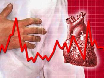 Các loại bệnh tim mạch thường gặp, có thể bạn chưa biết