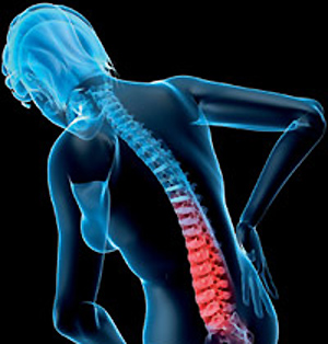 10 nguyên nhân hàng đầu được coi là "thủ phạm" gây ra chứng đau lưng