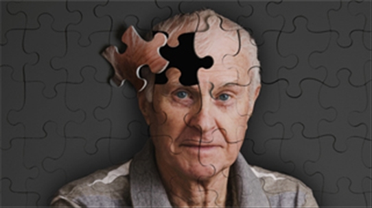 5 nguyên nhân gây bệnh Alzheimer không phải ai cũng biết