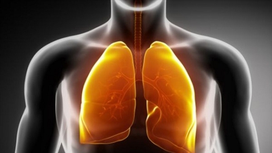 Bác sỹ chuyên khoa có những lưu ý cho bệnh nhân tràn dịch màng phổi