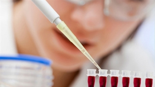 Nghiên cứu ứng dụng công nghệ tế bào gốc trong điều trị bệnh hen
