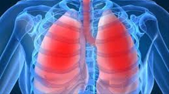 Nếu không nhanh chóng hạn chế tình trạng tràn dịch phổi có thể nguy hiểm đến tính mạng