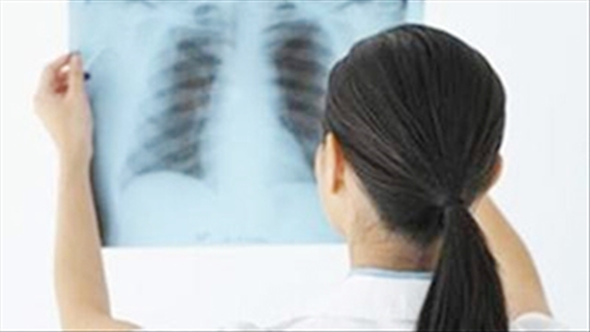 Lời khuyên của bác sỹ trong việc điều trị bệnh xơ phổi hiệu quả