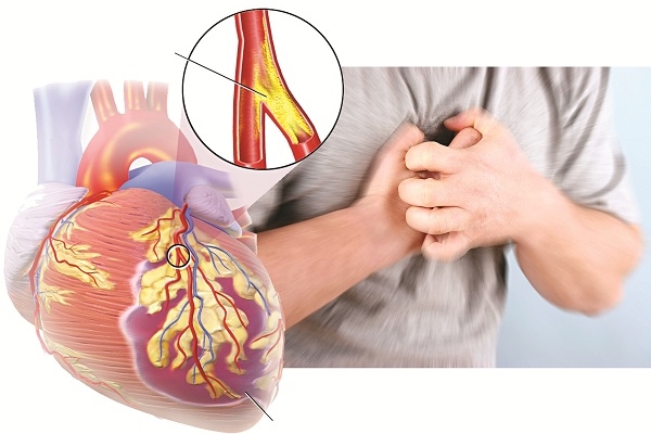 Những nguy cơ trên tim mạch khi bổ sung testosteron bạn đã biết