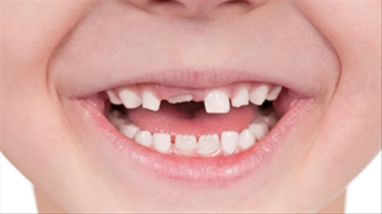 10 tháng tuổi chưa mọc răng có phải thiếu canxi hay không?