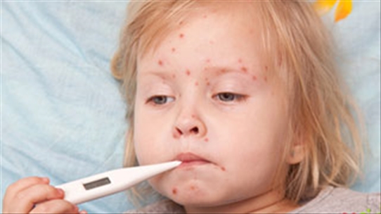 Cách phát hiện sớm sốt xuất huyết ở trẻ, có thể bạn chưa biết