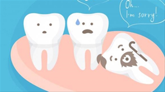 Biến chứng răng khôn mọc lệch nên chữa như thế nào?