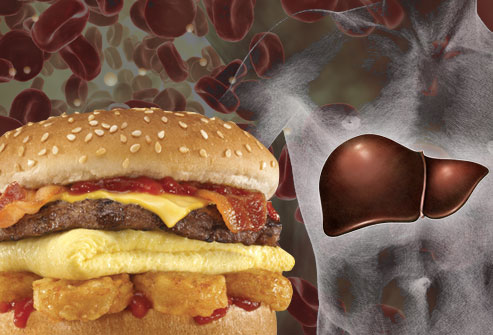 Cholesterol giúp bạn khỏe mạnh - cùng tìm hiểu xem sao