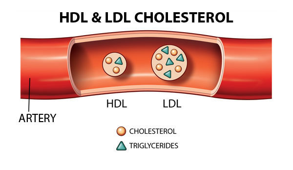 Cholesterol - Những điều cần biết để có một sức khỏe tốt