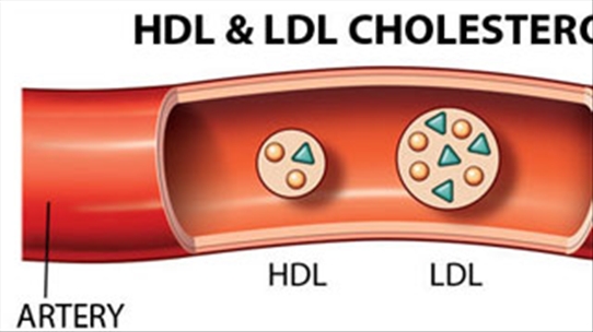 Cholesterol - Những điều cần biết giúp chúng ta luôn khỏe mạnh