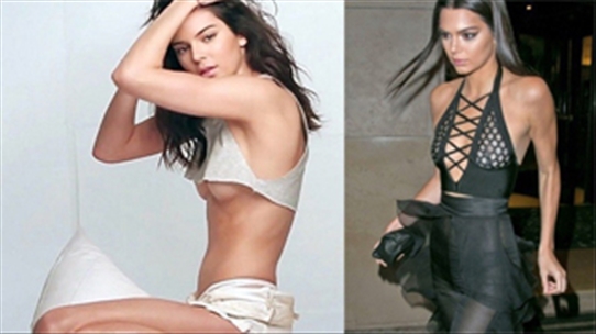 Siêu mẫu 9x Kendall Jenner xinh đẹp, giàu có thuộc top đầu thế giới giữ dáng bằng những mẹo đơn giản này