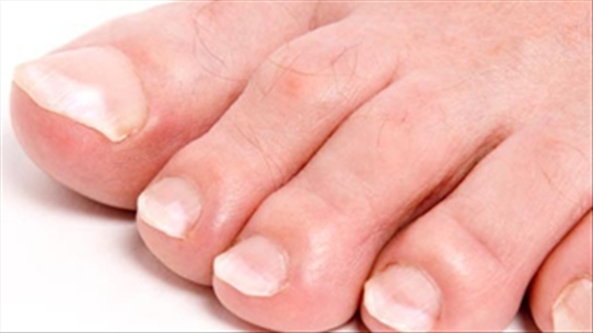 10 dấu hiệu lạ ở chân báo hiệu bạn đã mắc một số bệnh