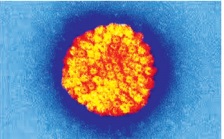 Viêm não do virut herpes âm thầm mà nguy hiểm, chớ chủ quan