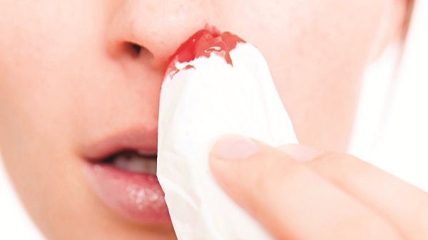 Chảy máu mũi gây nhiều biến chứng nguy hiểm, chớ xem nhẹ