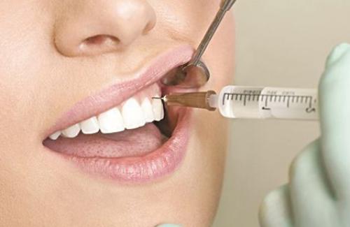 Viêm tủy răng - biểu hiện, nguyên nhân và điều trị bệnh