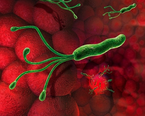 Làm sao để tránh nhiễm trùng Helicobacter Pylori ở dạ dày