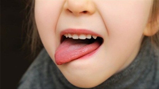 Nhận biết bệnh qua màu sắc lưỡi không phải ai cũng biết