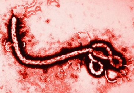 Sự khác nhau giữa bệnh Ebola và sốt xuất huyết, các bạn hãy chú ý thêm về căn bệnh này nhé!