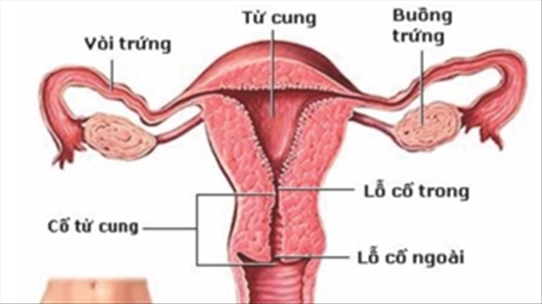 Ung thư cổ tử cung: Bệnh giết 9 phụ nữ mỗi ngày, chị em nên thận trọng