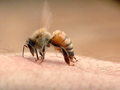 Làm thế nào khi bị ong đốt tránh đe dọa đến tính mạng của trẻ?