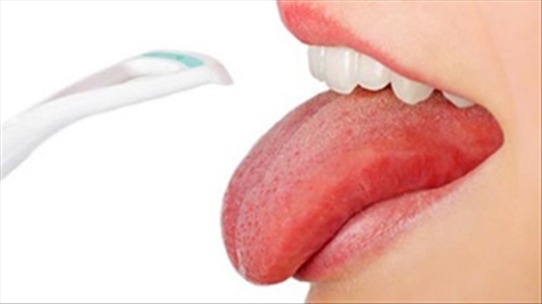 Trào ngược axit dạ dày gây ra tình trạng rát lưỡi, làm sao để khắc phục?