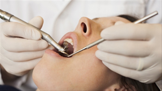 Những biến chứng nguy hại khi lấy cao răng có thể bạn chưa biết
