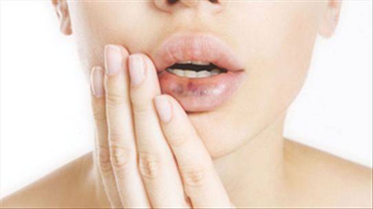 Dấu hiệu về sức khỏe mà bạn có thể dự đoán được khi nhìn vào màu sắc đôi môi