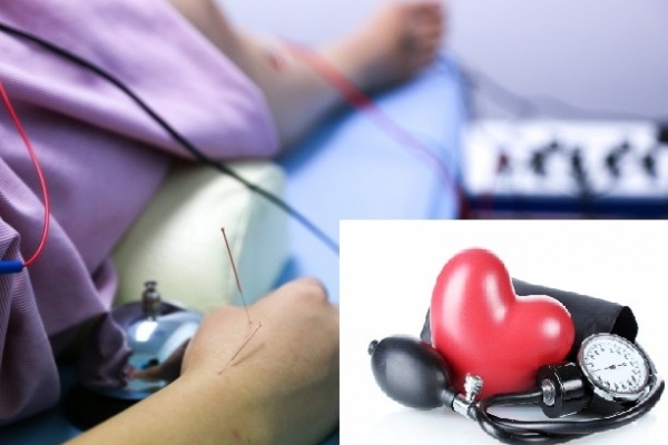 Điều trị bệnh tăng huyết áp bằng phương pháp điện châm