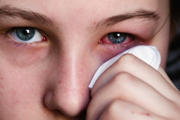 Mách bạn những loại dược thiện trị đau mắt đỏ hiệu quả