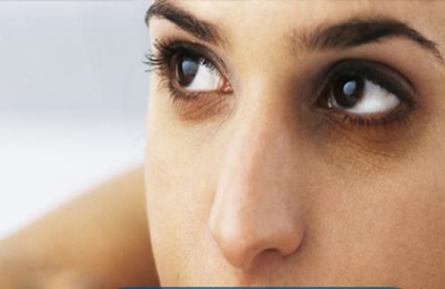 Quầng thâm ở mắt: Dấu hiệu cơ thể cảnh báo bệnh nguy hiểm