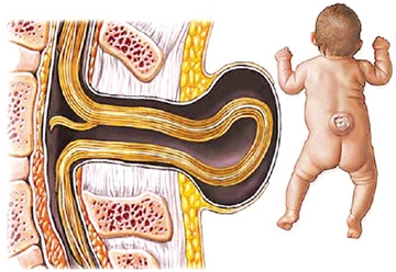 Những vai trò của chất sắt và acid folic trong thai kỳ